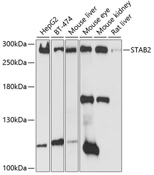 Western blot - STAB2 Polyclonal Antibody 