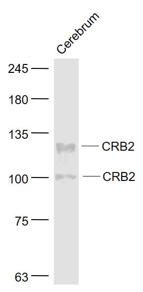 Fig4: Sample:; Cerebrum (Mouse) Lysate at 40 ug; Primary: Anti- CRB2 at 1/1000 dilution; Secondary: IRDye800CW Goat Anti-Rabbit IgG at 1/20000 dilution; Predicted band size: 100,123,131 kD; Observed band size: 100,131 kD