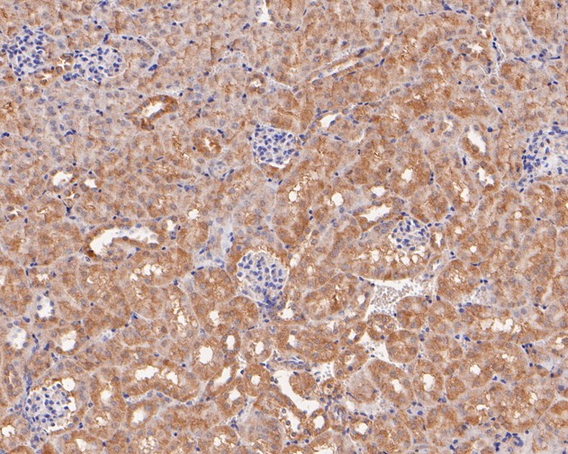 Fig2:; Immunohistochemical analysis of paraffin-embedded mouse kidney tissue using anti-Ly-6G antibody. The section was pre-treated using heat mediated antigen retrieval with Tris-EDTA buffer (pH 8.0-8.4) for 20 minutes.The tissues were blocked in 5% BSA for 30 minutes at room temperature, washed with ddH; 2; O and PBS, and then probed with the primary antibody ( 1/100) for 30 minutes at room temperature. The detection was performed using an HRP conjugated compact polymer system. DAB was used as the chromogen. Tissues were counterstained with hematoxylin and mounted with DPX.