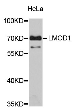 Western blot - LMOD1 Polyclonal Antibody 