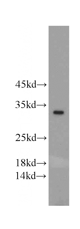 mouse colon tissue were subjected to SDS PAGE followed by western blot with Catalog No:110594(FAM57B antibody) at dilution of 1:500