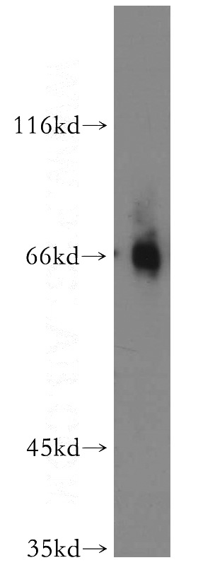 mouse ovary tissue were subjected to SDS PAGE followed by western blot with Catalog No:110159(SLC1A1 antibody) at dilution of 1:500