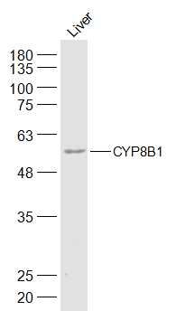 Fig2: Sample:; Liver (Mouse) Lysate at 40 ug; Primary: Anti-CYP8B1 at 1/300 dilution; Secondary: IRDye800CW Goat Anti-Rabbit IgG at 1/20000 dilution; Predicted band size: 58 kD; Observed band size: 58 kD