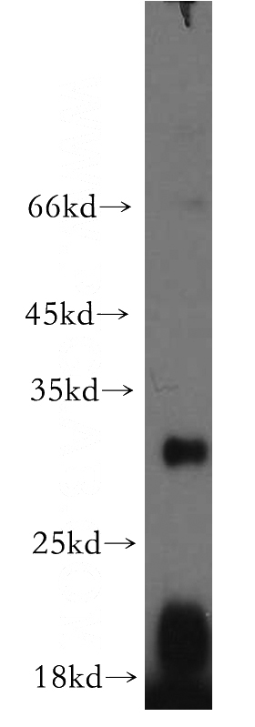 MCF7 cells were subjected to SDS PAGE followed by western blot with Catalog No:110169(EBI3 antibody) at dilution of 1:300
