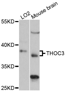 Western blot - THOC3 Polyclonal Antibody 