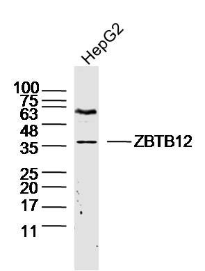 Fig1: Sample: HepG2 (human)Cell Lysate at 40 ug; Primary: Anti-ZBTB12 at 1/300 dilution; Secondary: IRDye800CW Goat Anti-Rabbit IgG at 1/20000 dilution; Predicted band size: 35 kD; Observed band size: 36 kD