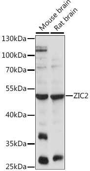Western blot - ZIC2 Polyclonal Antibody 