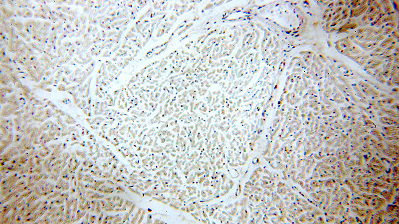 Immunohistochemical of paraffin-embedded human heart using Catalog No:115410(SLN antibody) at dilution of 1:100 (under 10x lens)