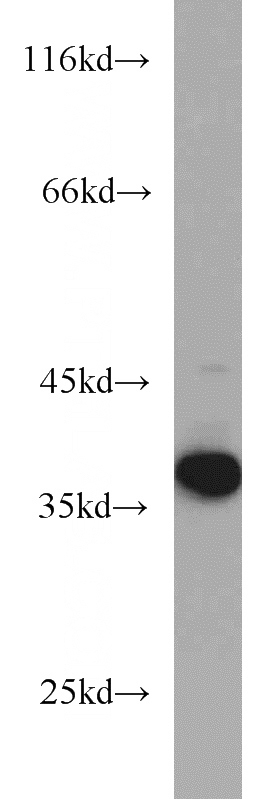 mouse colon tissue were subjected to SDS PAGE followed by western blot with Catalog No:111951(ITLN1 antibody) at dilution of 1:300