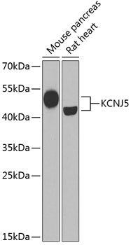 Western blot - KCNJ5 Polyclonal Antibody 