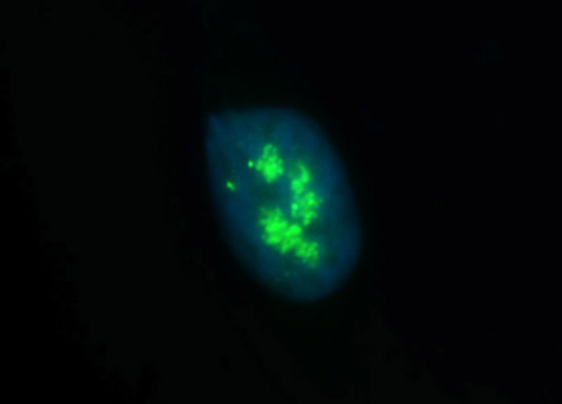 Immunofluorescent analysis of HepG2 cells, using NOLC1 antibody Catalog No:113299 at 1:50 dilution and FITC-labeled donkey anti-rabbit IgG(green). Blue pseudocolor = DAPI (fluorescent DNA dye).