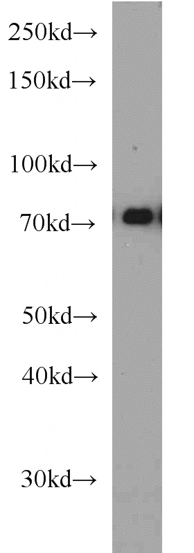 HEK-293 cells were subjected to SDS PAGE followed by western blot with Catalog No:115963(HRD1 antibody) at dilution of 1:1000