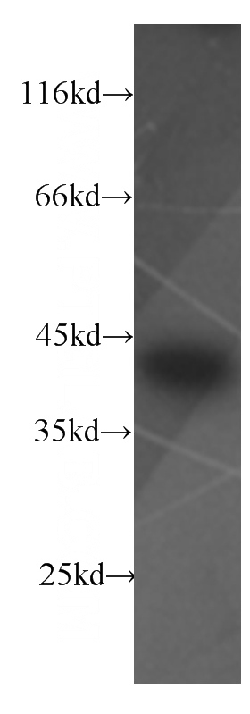 Raji cells were subjected to SDS PAGE followed by western blot with Catalog No:107594(SMN2 antibody) at dilution of 1:400