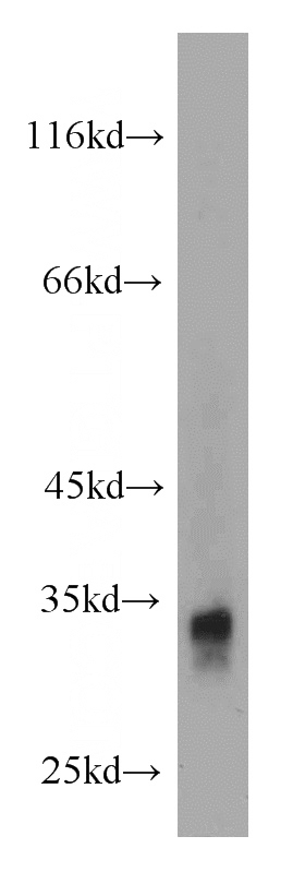 mouse ovary tissue were subjected to SDS PAGE followed by western blot with Catalog No:110650(FHL2 antibody) at dilution of 1:1000