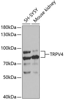 Western blot - TRPV4 Polyclonal Antibody 