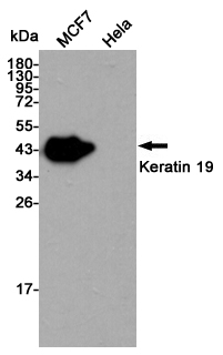 Western blot detection of Keratin 19 in MCF7 and Hela cell lysates using Keratin 19 mouse mAb (1:5000 diluted).As expected, the protein is absent in Hela cells.Predicted band size:44KDa.Observed band size:40KDa.