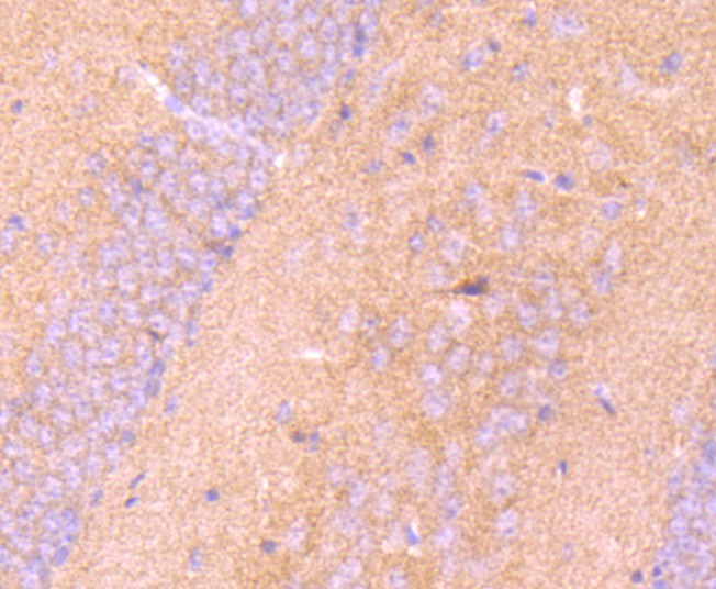 Fig2: Immunohistochemical analysis of paraffin-embedded mouse brain tissue using anti-LRRK1 antibody. Counter stained with hematoxylin.