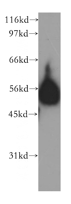 human brain tissue were subjected to SDS PAGE followed by western blot with Catalog No:110326(ENPP6 antibody) at dilution of 1:500