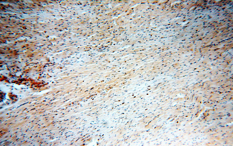 Immunohistochemical of paraffin-embedded human heart using Catalog No:112157(LATS2-Specific antibody) at dilution of 1:100 (under 10x lens)