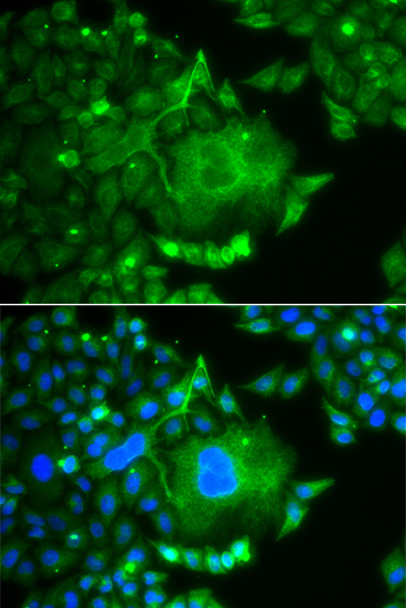 Immunofluorescence - CACNG4 Polyclonal Antibody 