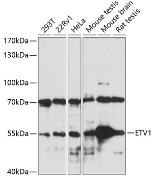 Western blot - ETV1 Polyclonal Antibody 