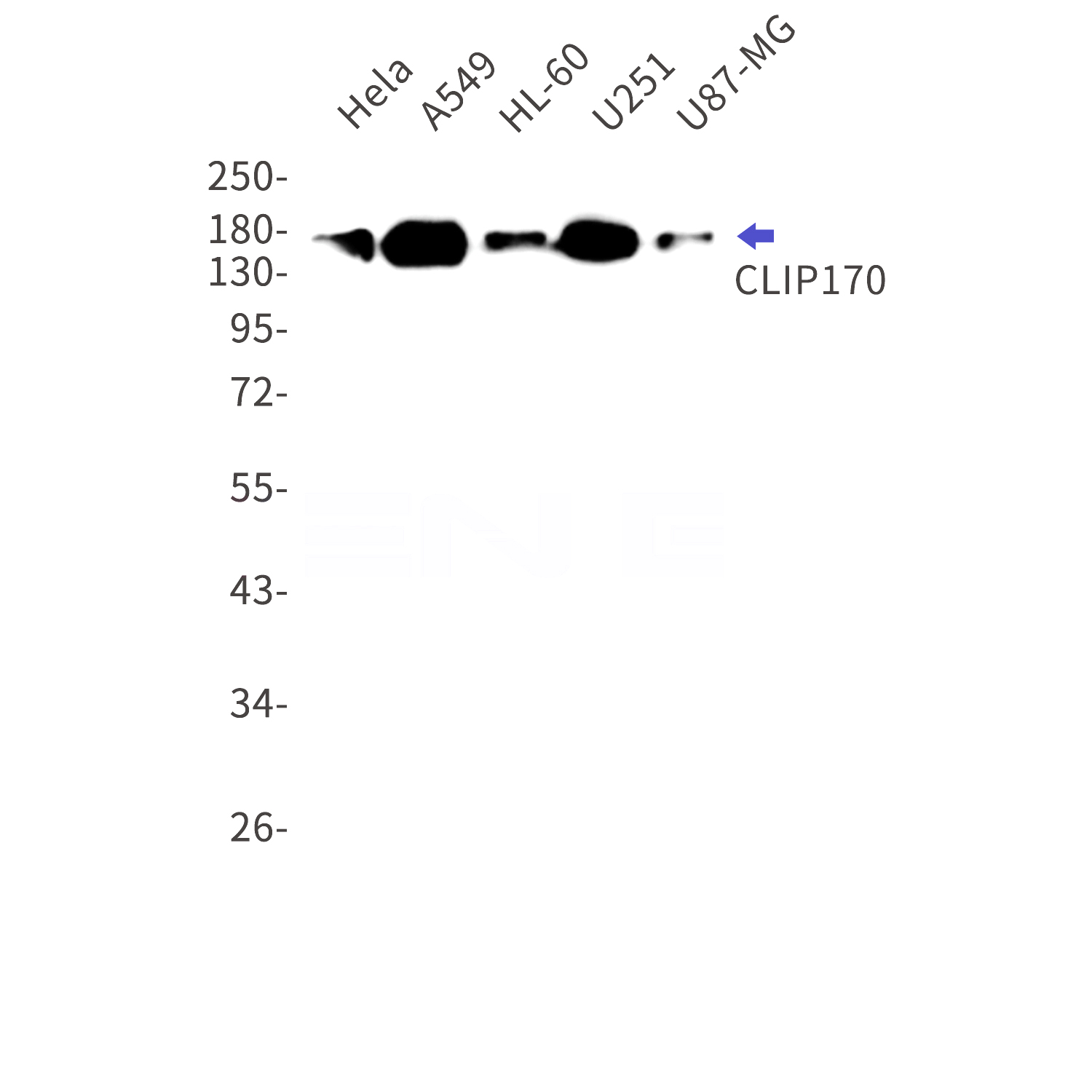 Western blot detection of CLIP170 in Hela,A549,HL-60,U251,U87-MG cell lysates using CLIP170 Rabbit mAb(1:1000 diluted).Predicted band size:162kDa.Observed band size:170kDa.