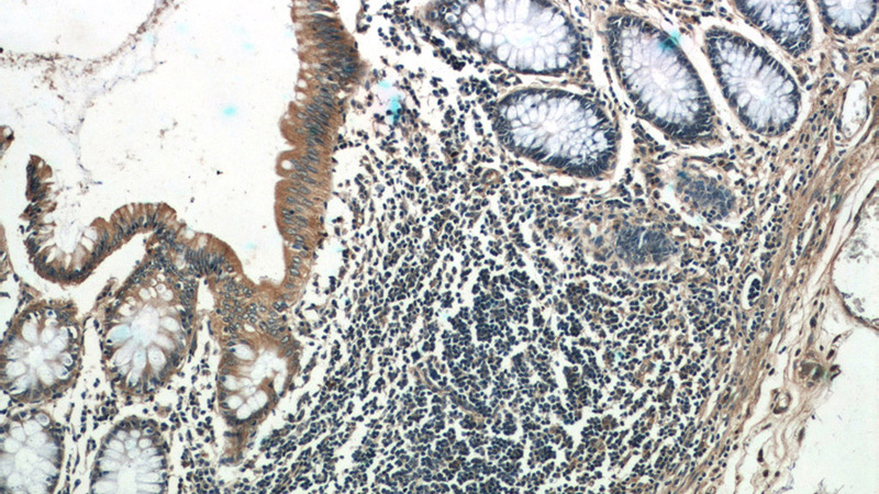 Immunohistochemistry of paraffin-embedded human colon tissue slide using Catalog No:111724(humanin Antibody) at dilution of 1:50 (under 10x lens)
