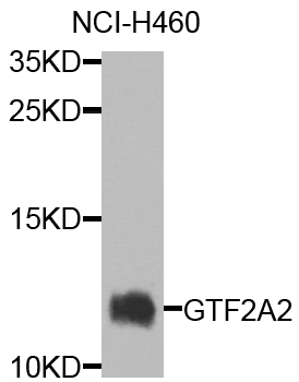 Western blot - GTF2A2 Polyclonal Antibody 