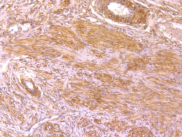 Fig4: Immunohistochemical analysis of paraffin-embedded rat cervix tissue using anti-BLCAP antibody. Counter stained with hematoxylin.