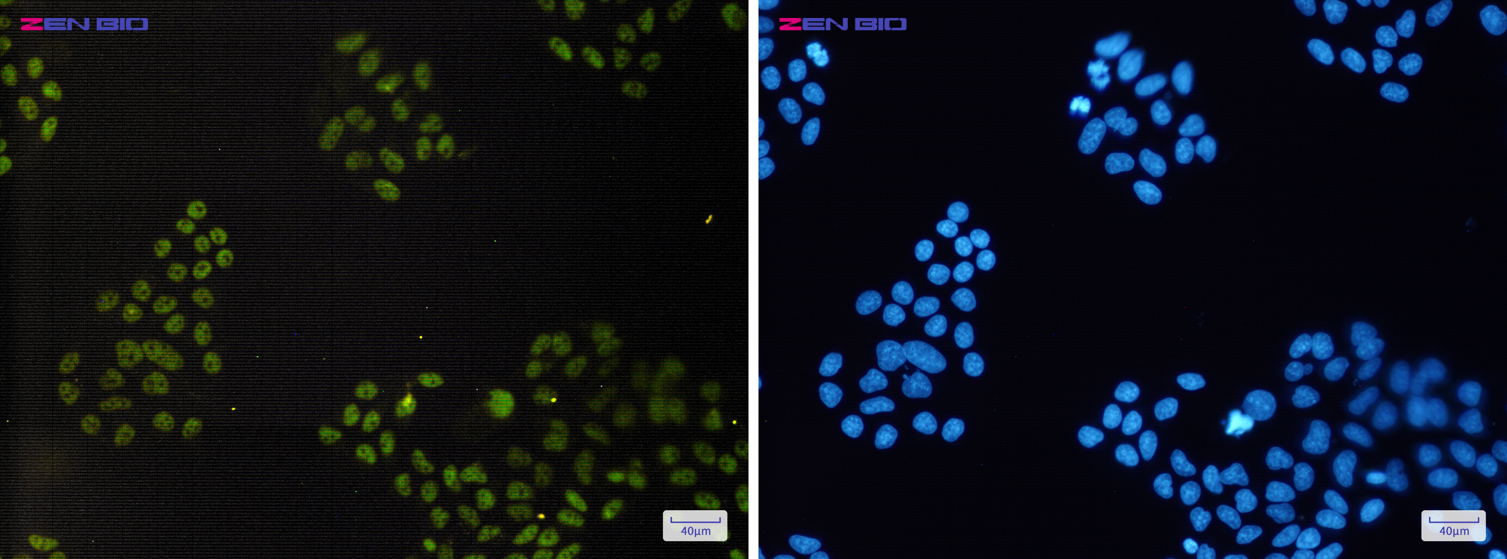 Immunocytochemistry of CGBP(green) in Hela cells using CGBP Rabbit pAb at dilution 1/50, and DAPI(blue)