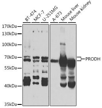 Western blot - PRODH Polyclonal Antibody 