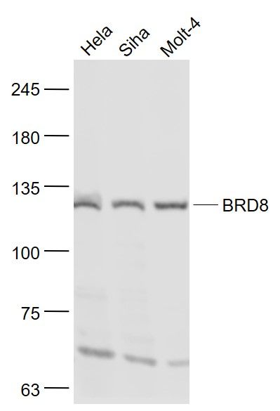 Fig1: Sample:; Hela(Human) Cell Lysate at 30 ug; Siha(Human) Cell Lysate at 30 ug; Molt-4(Human) Cell Lysate at 30 ug; Primary: Anti- BRD8 at 1/1000 dilution; Secondary: IRDye800CW Goat Anti-Rabbit IgG at 1/20000 dilution; Predicted band size: 135 kD; Observed band size: 130 kD