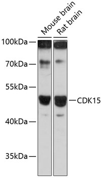 Western blot - CDK15 Polyclonal Antibody 