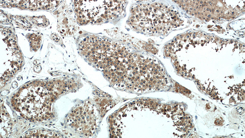 Immunohistochemical of paraffin-embedded human testis using Catalog No:108643(C11orf70 antibody) at dilution of 1:50 (under 10x lens)