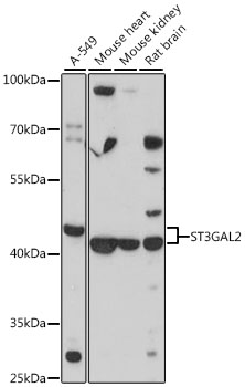 Western blot - ST3GAL2 Polyclonal Antibody 