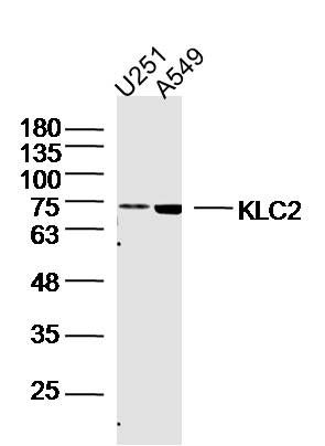 Fig1: Sample:; U251 Cell (Human) Lysate at 40 ug; A549 Cell (Human) Lysate at 40 ug; Primary: Anti- KLC2 at 1/300 dilution; Secondary: IRDye800CW Goat Anti-Rabbit IgG at 1/20000 dilution; Predicted band size: 69 kD; Observed band size: 69 kD