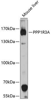 Western blot - PPP1R3A Polyclonal Antibody 