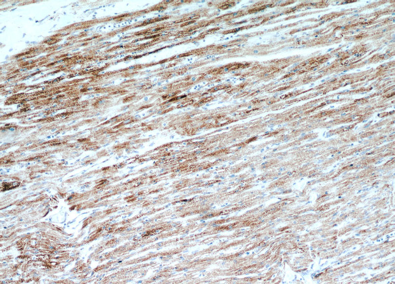 Immunohistochemical of paraffin-embedded human heart using Catalog No:112325(LRPPRC antibody) at dilution of 1:100 (under 10x lens)