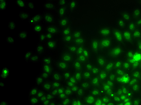Immunofluorescence - IWS1 Polyclonal Antibody 