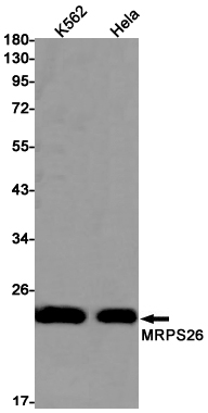 Western blot detection of MRPS26 in K562,Hela cell lysates using MRPS26 Rabbit pAb(1:1000 diluted).Predicted band size:24kDa.Observed band size:24kDa.
