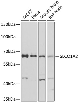 Western blot - SLCO1A2 Polyclonal Antibody 