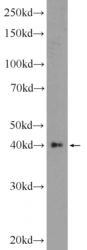 HEK-293 cells were subjected to SDS PAGE followed by western blot with Catalog No:107936(AKD1 Antibody) at dilution of 1:600