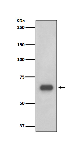 Western blot analysis of p70 S6 Kinase expression in 293T cell lysate.