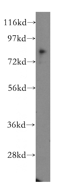 K-562 cells were subjected to SDS PAGE followed by western blot with Catalog No:109060(CD164 antibody) at dilution of 1:300