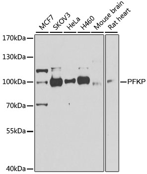 Western blot - PFKP Polyclonal Antibody 