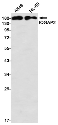 Western blot detection of IQGAP2 in A549,HL-60 using IQGAP2 Rabbit mAb(1:1000 diluted)