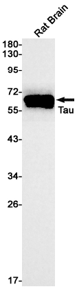 Western blot detection of Tau in Rat Brain cell using Tau Rabbit mAb(1:1000 diluted).Predicted band size:79kDa.Observed band size:50-80kDa.