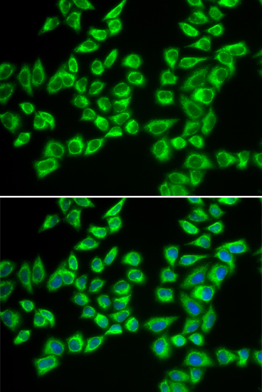 Immunofluorescence - HADHB Polyclonal Antibody 