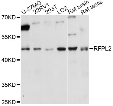 Western blot - RFPL2 Polyclonal Antibody 