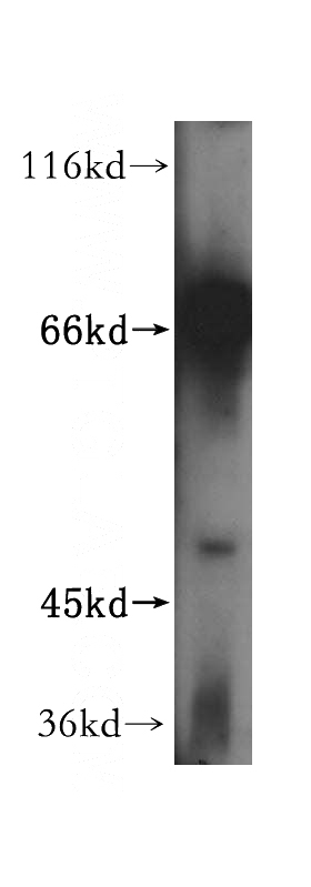 HeLa cells were subjected to SDS PAGE followed by western blot with Catalog No:114712(RIOK1 antibody) at dilution of 1:500